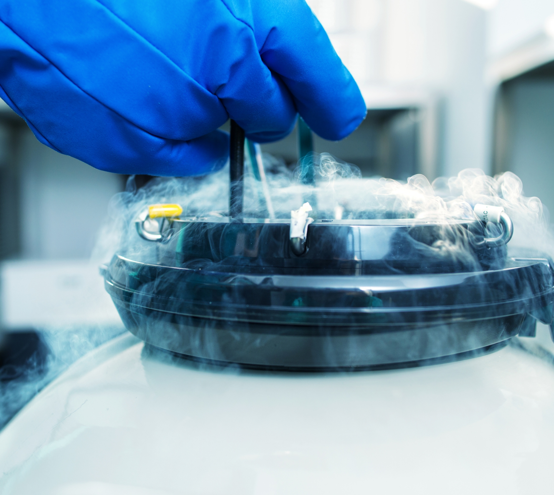 When Should You Freeze Your Eggs? Expert Advice for Women in Their 20s and 30s
